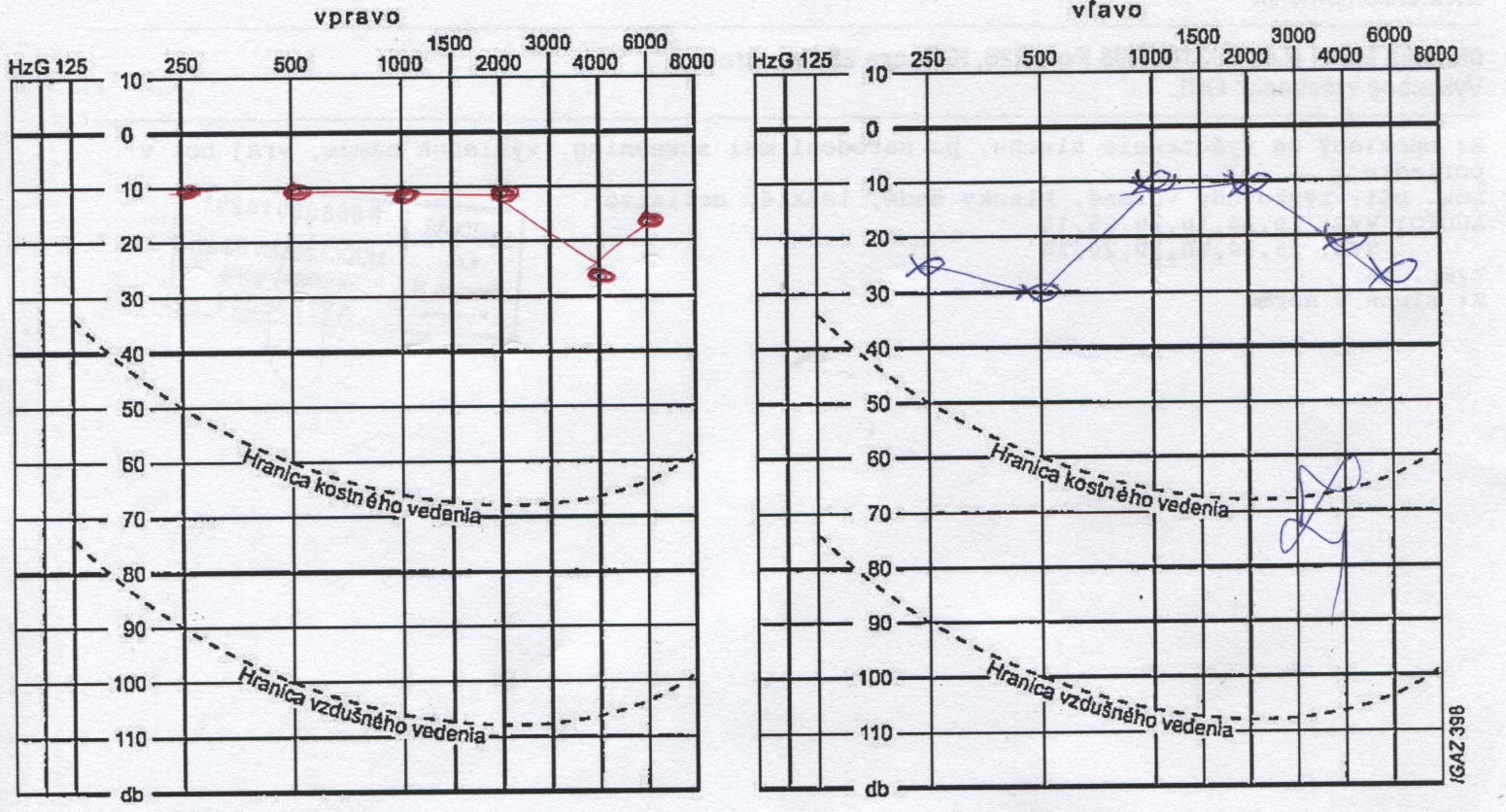 audiometria